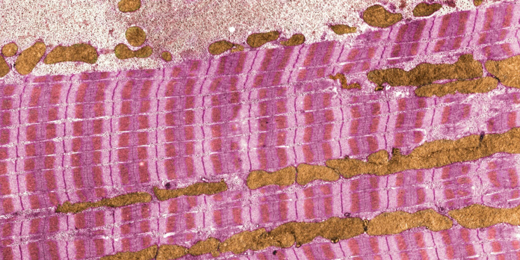 muscle-ultrastructure