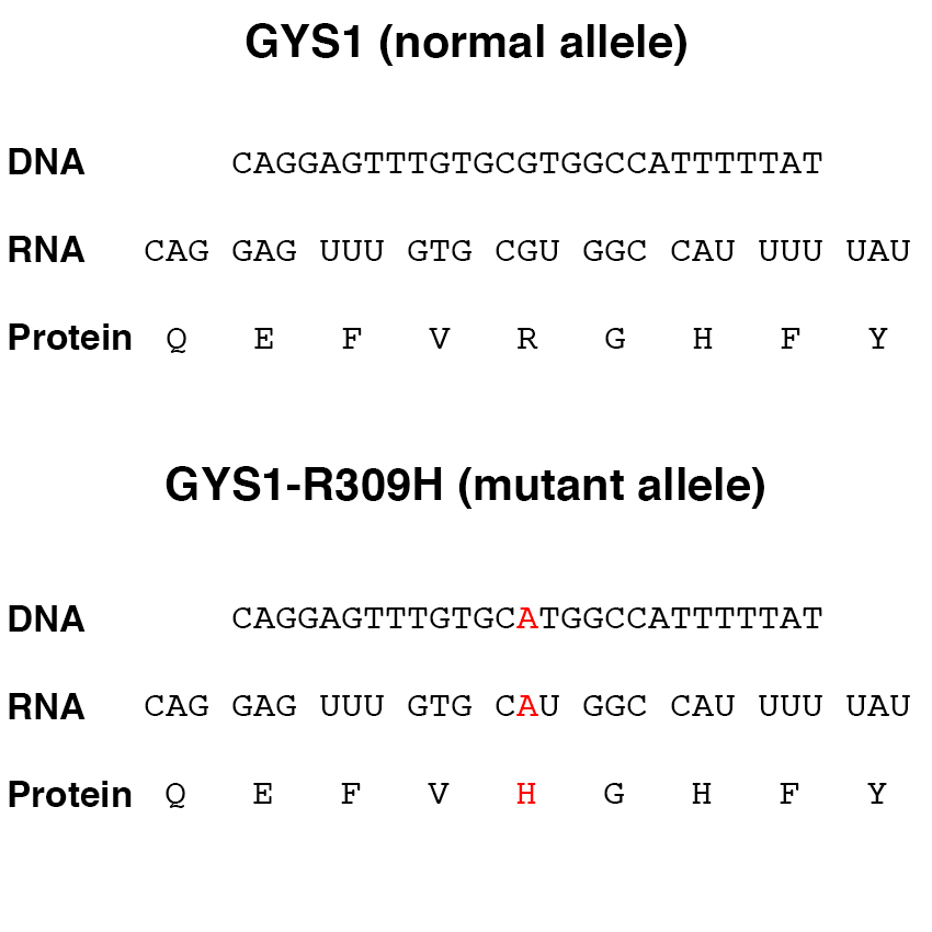 DNA sequence, RNA sequence separated into codons, and protein sequence for a portion of the gene for glycogen synthase I (GYS1) and the GYS1-R309H variant allele.